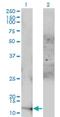 Acylphosphatase 1 antibody, H00000097-M01, Novus Biologicals, Western Blot image 