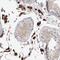Synaptotagmin Like 5 antibody, HPA026074, Atlas Antibodies, Immunohistochemistry paraffin image 