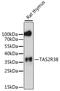 Taste 2 Receptor Member 38 antibody, LS-C750058, Lifespan Biosciences, Western Blot image 
