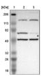 Mirror-image polydactyly gene 1 protein antibody, NBP1-86161, Novus Biologicals, Western Blot image 