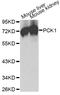 Phosphoenolpyruvate carboxykinase, cytosolic [GTP] antibody, A2036, ABclonal Technology, Western Blot image 