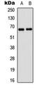 P21 (RAC1) Activated Kinase 1 antibody, MBS8221574, MyBioSource, Western Blot image 
