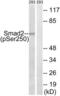 SMAD2 antibody, LS-C199581, Lifespan Biosciences, Western Blot image 