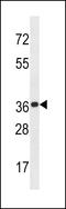 Potassium Channel Tetramerization Domain Containing 20 antibody, LS-C157848, Lifespan Biosciences, Western Blot image 