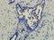 Keratin 7 antibody, orb13342, Biorbyt, Immunohistochemistry paraffin image 