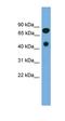 Receptor Interacting Serine/Threonine Kinase 4 antibody, orb330454, Biorbyt, Western Blot image 