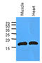Myoglobin antibody, LS-B8968, Lifespan Biosciences, Western Blot image 