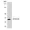 Serine/arginine-rich splicing factor 8 antibody, LS-C200660, Lifespan Biosciences, Western Blot image 