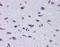 Diencephalon/Mesencephalon Homeobox 1 antibody, NBP1-80255, Novus Biologicals, Immunohistochemistry paraffin image 