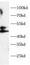 MHC Class I Polypeptide-Related Sequence B antibody, FNab10743, FineTest, Western Blot image 