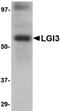 Leucine-rich repeat LGI family member 3 antibody, PA5-20494, Invitrogen Antibodies, Western Blot image 