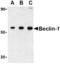 Beclin 1 antibody, AHP1009, Bio-Rad (formerly AbD Serotec) , Western Blot image 
