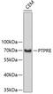 Receptor-type tyrosine-protein phosphatase epsilon antibody, 19-262, ProSci, Western Blot image 