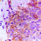 Fibroblast growth factor receptor 2 antibody, LS-C352200, Lifespan Biosciences, Immunohistochemistry paraffin image 