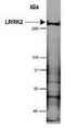 Leucine Rich Repeat Kinase 2 antibody, TA309736, Origene, Western Blot image 