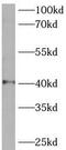 Solute Carrier Family 25 Member 3 antibody, FNab07939, FineTest, Western Blot image 