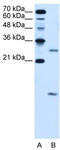 Vacuolar ATPase Assembly Factor VMA21 antibody, TA336068, Origene, Western Blot image 