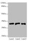 ETHE1 Persulfide Dioxygenase antibody, A58974-100, Epigentek, Western Blot image 