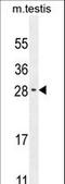 RELT Like 2 antibody, LS-C162537, Lifespan Biosciences, Western Blot image 
