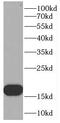 O-Acyl-ADP-Ribose Deacylase 1 antibody, FNab01124, FineTest, Western Blot image 