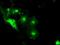 Solute Carrier Family 2 Member 5 antibody, GTX83627, GeneTex, Immunocytochemistry image 