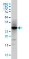 Histamine N-Methyltransferase antibody, LS-C197428, Lifespan Biosciences, Western Blot image 