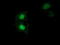 Stp antibody, TA501837, Origene, Immunofluorescence image 
