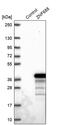 Zinc Finger Protein 688 antibody, PA5-61838, Invitrogen Antibodies, Western Blot image 