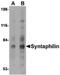 Syntaphilin antibody, PA5-20528, Invitrogen Antibodies, Western Blot image 