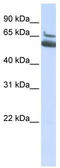 Arachidonate 15-Lipoxygenase Type B antibody, TA346267, Origene, Western Blot image 