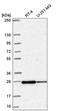 RAB11B, Member RAS Oncogene Family antibody, HPA054396, Atlas Antibodies, Western Blot image 