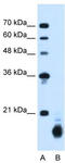 Peptidylprolyl Isomerase B antibody, TA335268, Origene, Western Blot image 