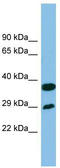 Receptor Transporter Protein 4 antibody, TA344692, Origene, Western Blot image 