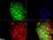 CD81 Molecule antibody, NB100-65805, Novus Biologicals, Immunocytochemistry image 
