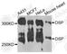 Desmoplakin antibody, A7635, ABclonal Technology, Western Blot image 
