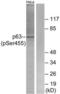Tumor Protein P63 antibody, LS-C199387, Lifespan Biosciences, Western Blot image 