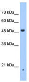 Zinc Finger DHHC-Type Containing 16 antibody, TA339609, Origene, Western Blot image 
