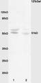 Myocyte Enhancer Factor 2C antibody, orb6414, Biorbyt, Western Blot image 