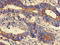 Protein Phosphatase, Mg2+/Mn2+ Dependent 1K antibody, LS-C399461, Lifespan Biosciences, Immunohistochemistry paraffin image 