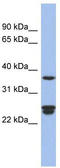 Ornithine Decarboxylase Antizyme 2 antibody, TA337673, Origene, Western Blot image 