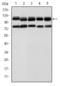 Bone Morphogenetic Protein Receptor Type 2 antibody, STJ97876, St John