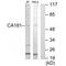 Zinc Finger HIT-Type Containing 6 antibody, A12719, Boster Biological Technology, Western Blot image 
