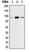 Transient Receptor Potential Cation Channel Subfamily V Member 1 antibody, orb215531, Biorbyt, Western Blot image 