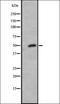 Fms Related Tyrosine Kinase 4 antibody, orb335499, Biorbyt, Western Blot image 