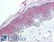 Histone Deacetylase 4 antibody, LS-B1999, Lifespan Biosciences, Immunohistochemistry frozen image 