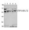 Cytochrome P450 Family 11 Subfamily B Member 1 antibody, A03766, Boster Biological Technology, Western Blot image 