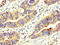ATP Binding Cassette Subfamily D Member 2 antibody, LS-C672571, Lifespan Biosciences, Immunohistochemistry paraffin image 
