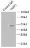FKBP5 antibody, FNab03141, FineTest, Immunoprecipitation image 