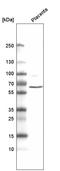 Adhesion G Protein-Coupled Receptor L4 antibody, AMAb91268, Atlas Antibodies, Western Blot image 