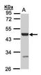 Uronyl 2-Sulfotransferase antibody, GTX105084, GeneTex, Western Blot image 